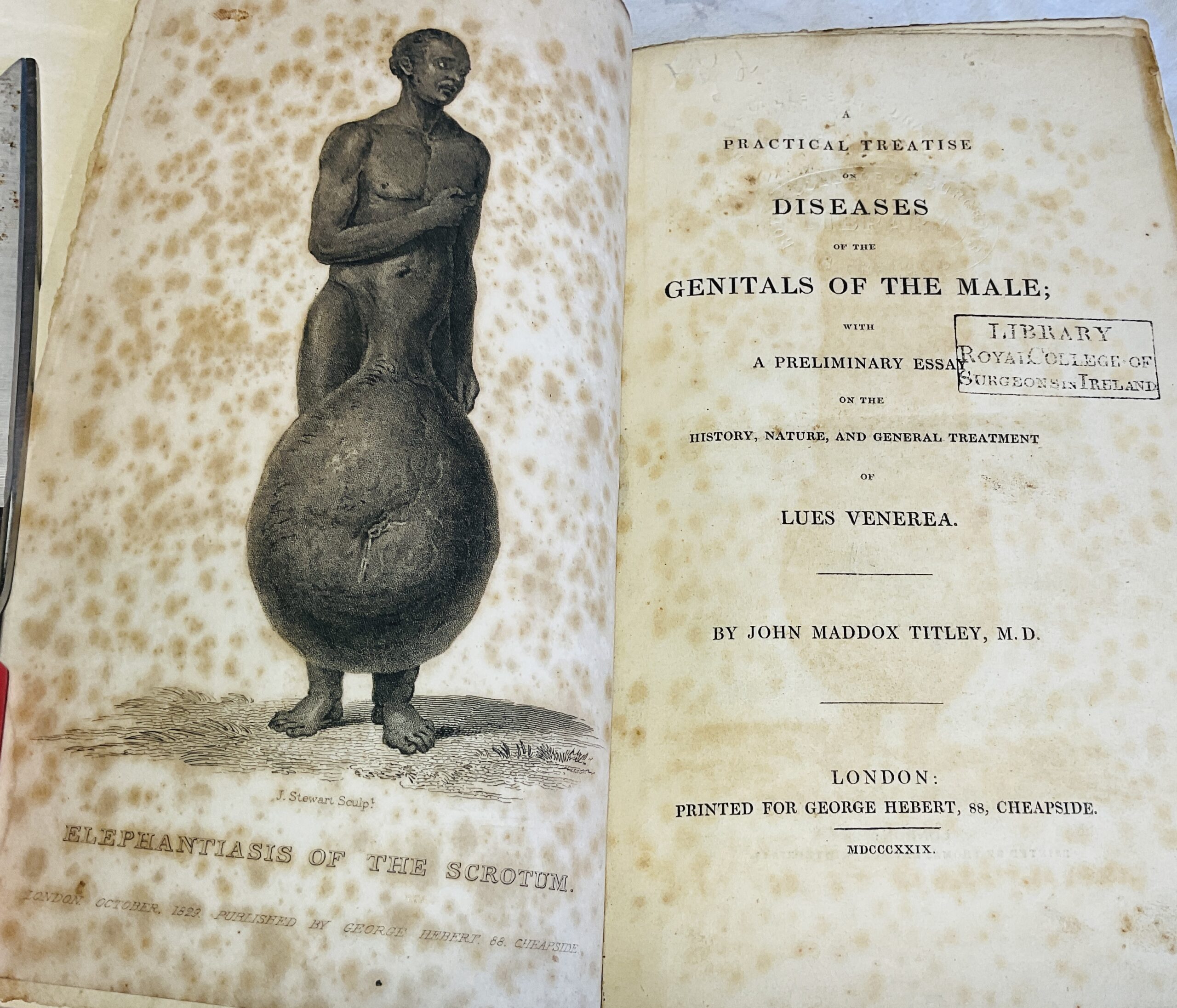 A Practical Treatise on Diseases of the Genitals of the Male: With a Preliminary Essay on the History Nature and General Treatment of Lues Venerea - Image 4